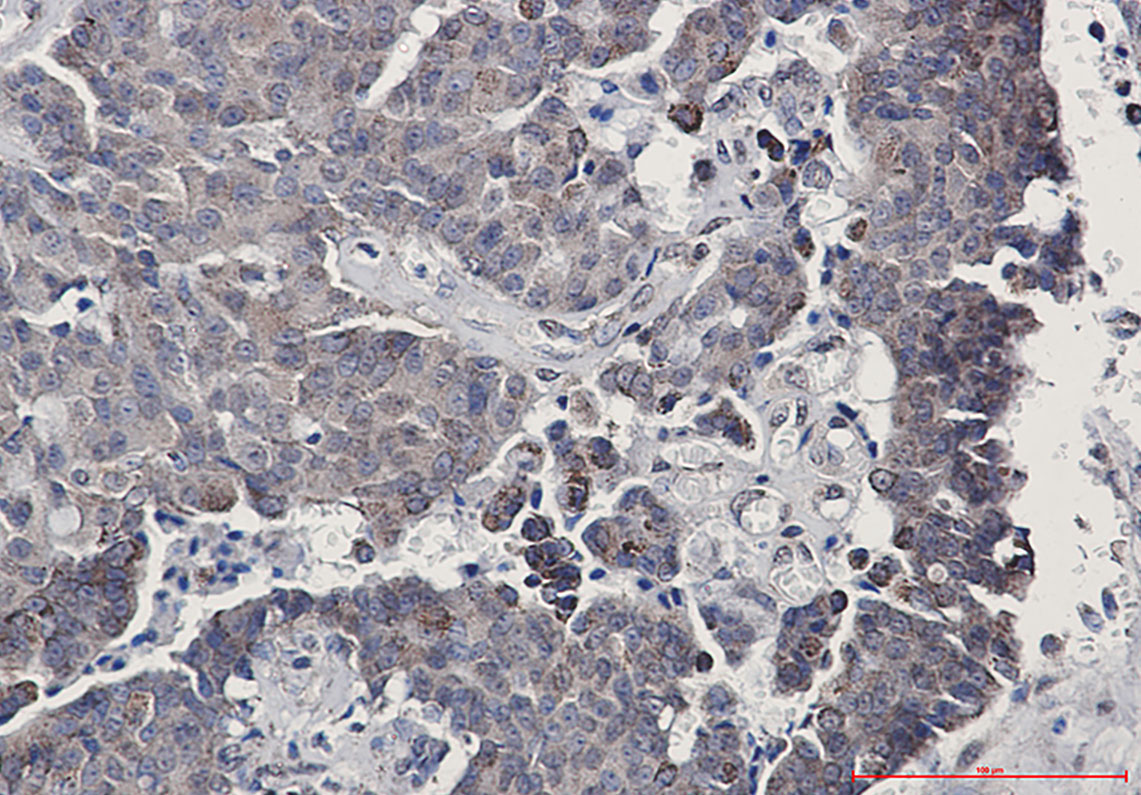 Rabbit Monoclonal Antibody to SIRT3