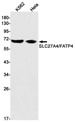 SLC27A4