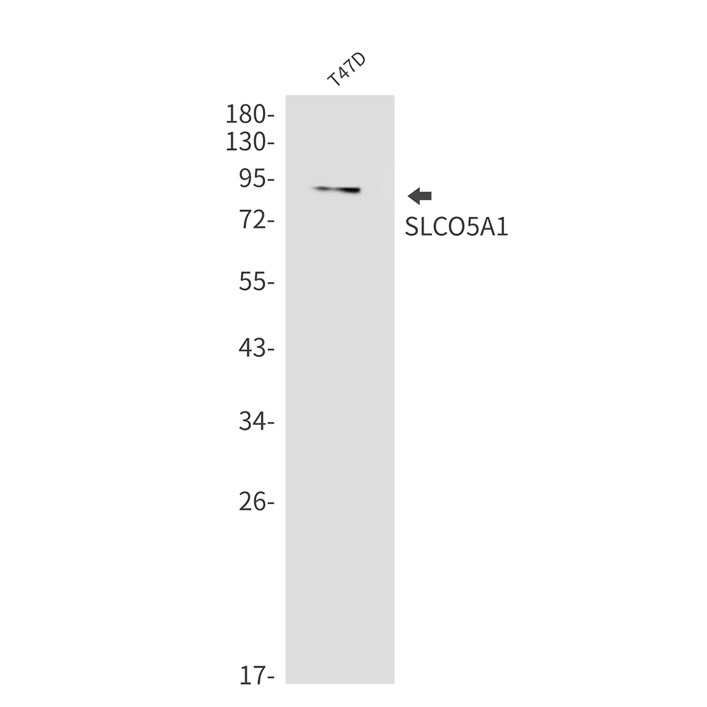 SLCO5A1