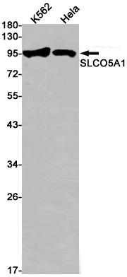 Rabbit Monoclonal Antibody to SLCO5A1