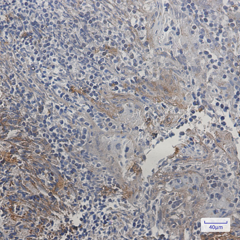 Rabbit Monoclonal Antibody to SMAC
