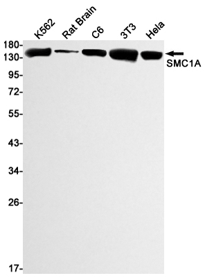 SMC1A