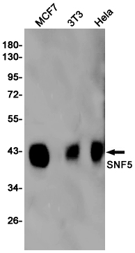 SMARCB1