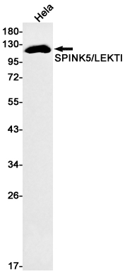 SPINK5