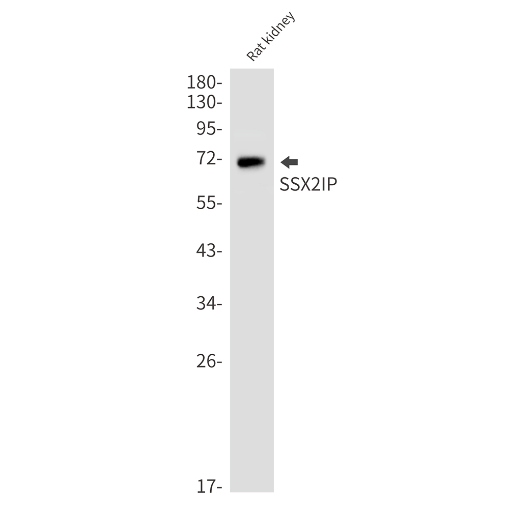 SSX2IP