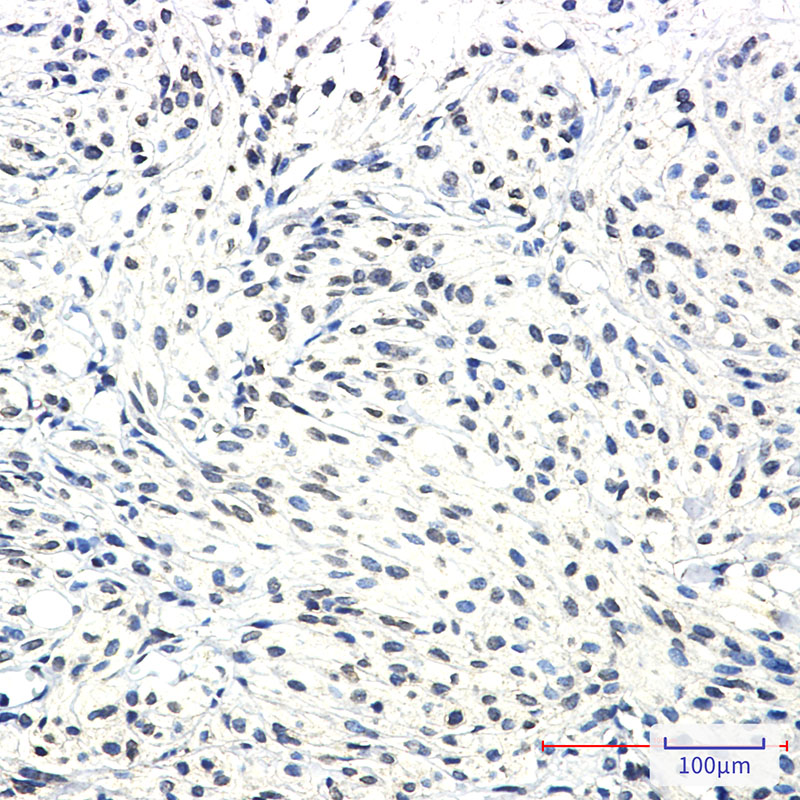 Rabbit Monoclonal Antibody to SSX2IP