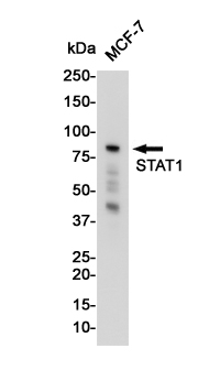 STAT1