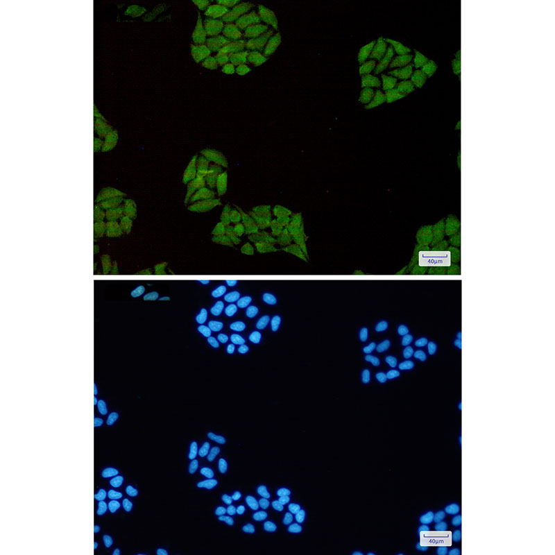 Rabbit Monoclonal Antibody to STAT1