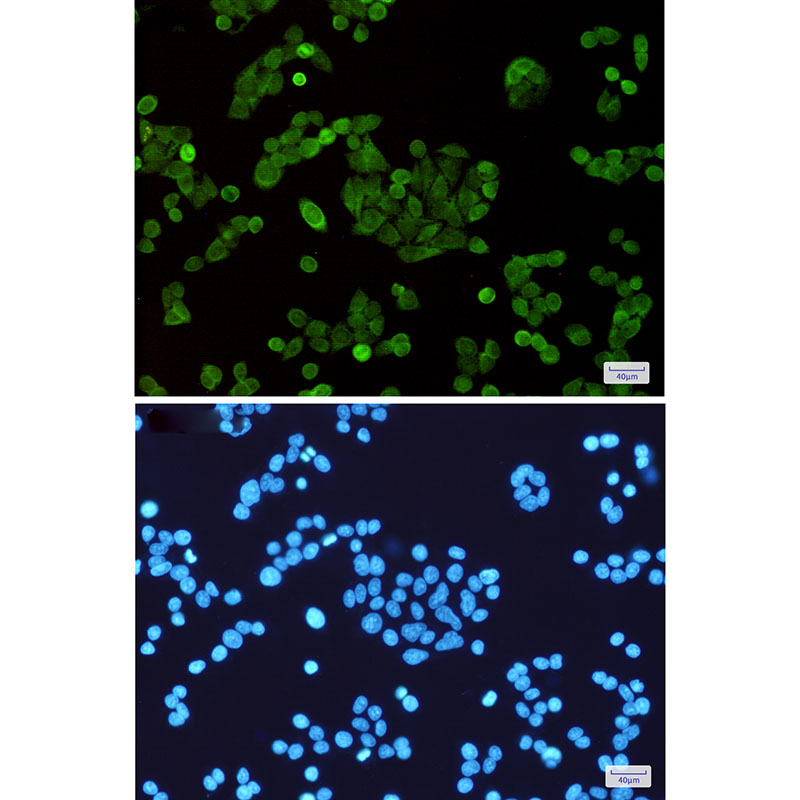 Rabbit Monoclonal Antibody to STAT5