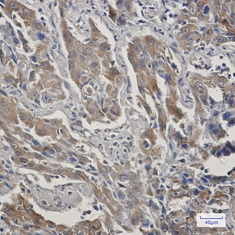 Rabbit Monoclonal Antibody to STIP1