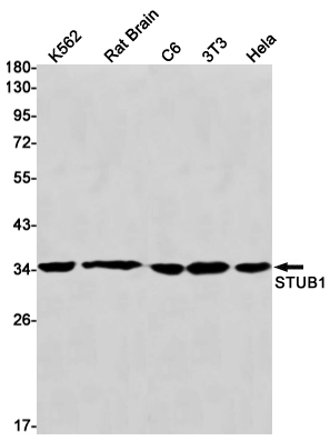 STUB1
