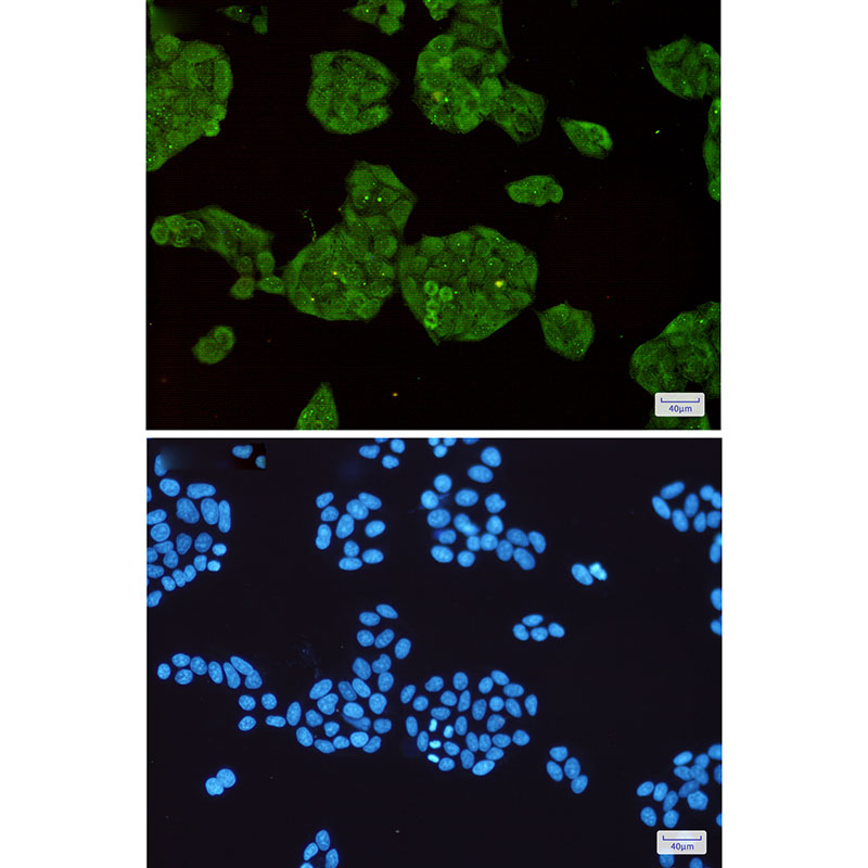 Rabbit Monoclonal Antibody to STUB1