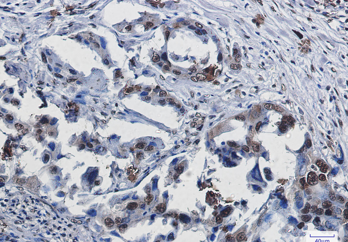Rabbit Monoclonal Antibody to SUMO1