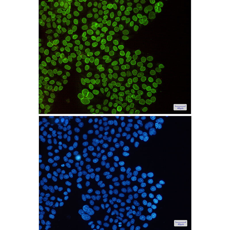 Rabbit Monoclonal Antibody to SUN1