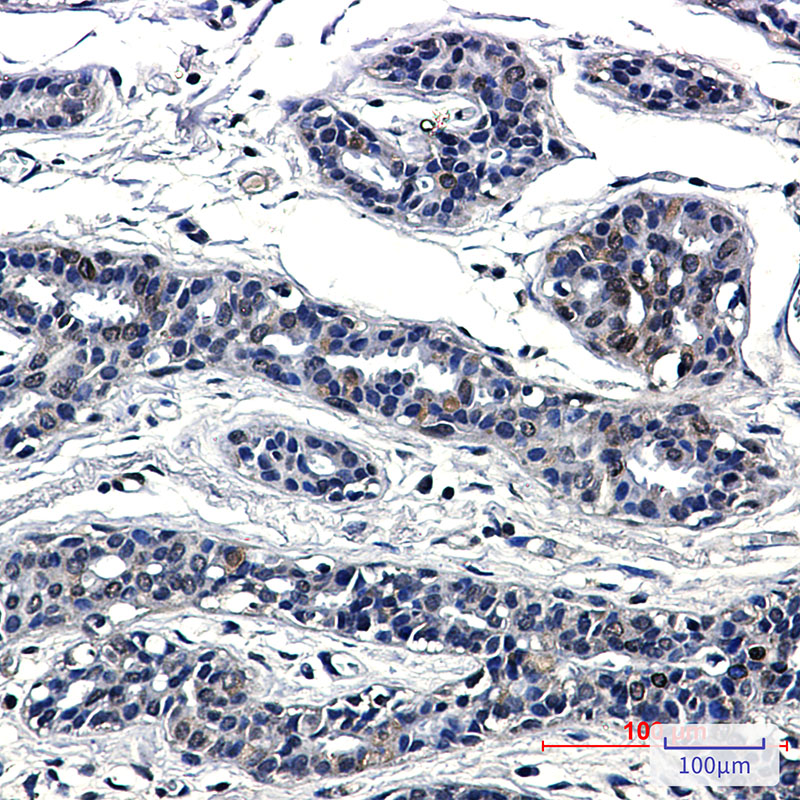 Rabbit Monoclonal Antibody to SUN1