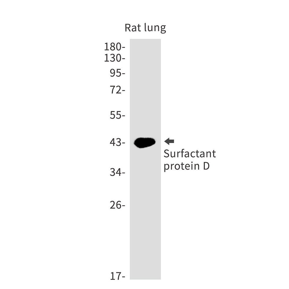 Pulmonary Surfactant Associated Protein D