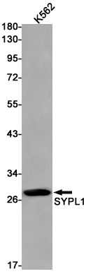 Synaptophysin Like Protein 1