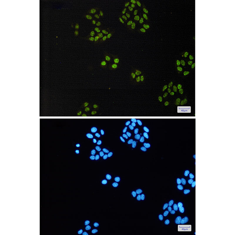 Rabbit Monoclonal Antibody to TAF15