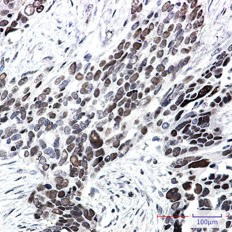 Rabbit Monoclonal Antibody to Transcription Factor 7 Like 2