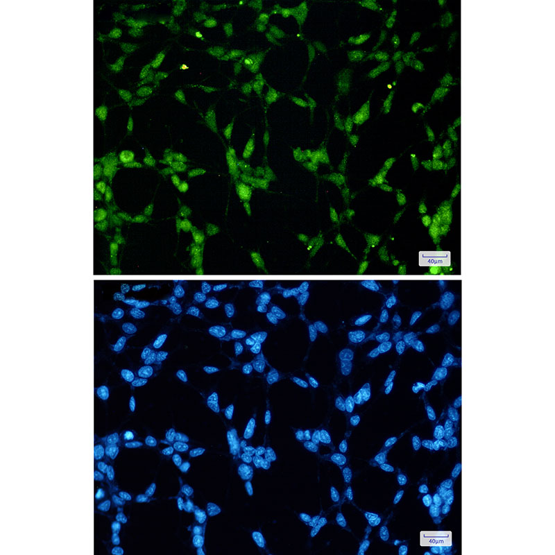 Rabbit Monoclonal Antibody to TDP 43