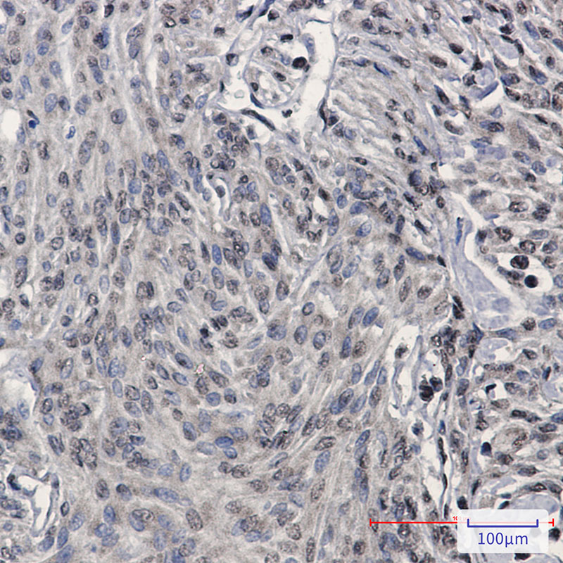 Rabbit Monoclonal Antibody to TDP 43