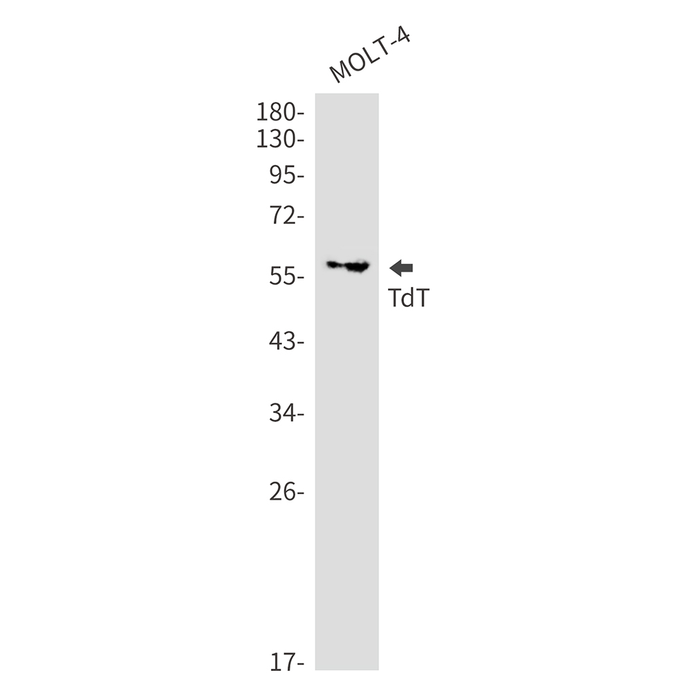DNA Nucleotidylexotransferase