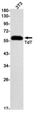 Rabbit Monoclonal Antibody to DNA Nucleotidylexotransferase