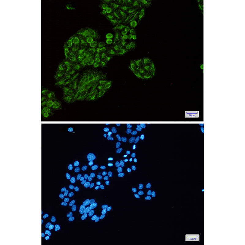 Rabbit Monoclonal Antibody to Tec