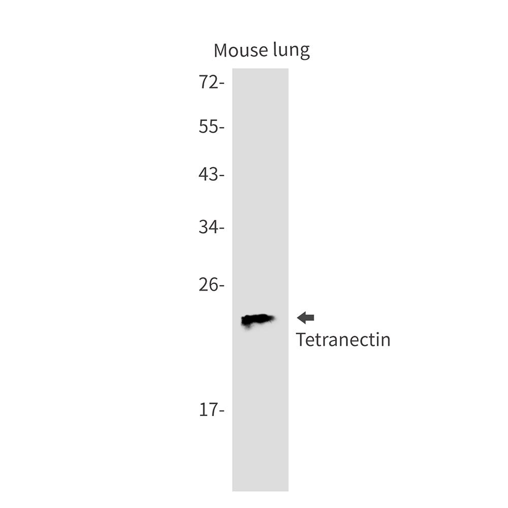 Tetranectin