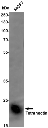 Rabbit Monoclonal Antibody to Tetranectin