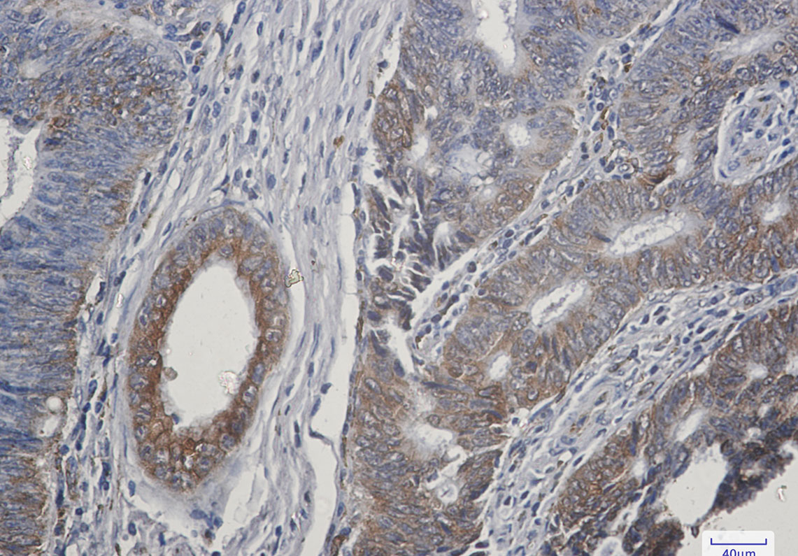 Rabbit Monoclonal Antibody to TGF alpha