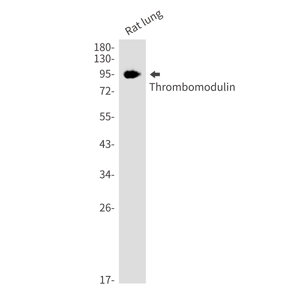 Thrombomodulin
