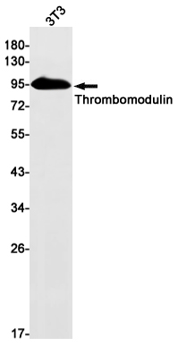 Rabbit Monoclonal Antibody to Thrombomodulin