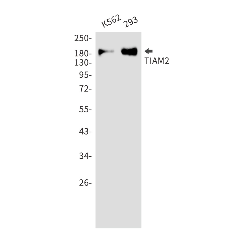 TIAM2