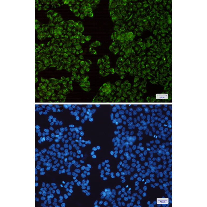 Rabbit Monoclonal Antibody to TIMM44
