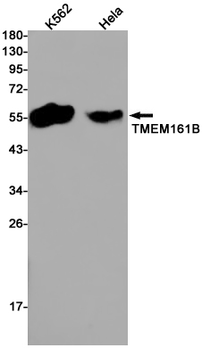 Transmembrane Protein 161B