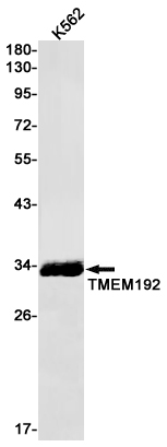 Transmembrane Protein 192