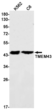 Transmembrane Protein 43