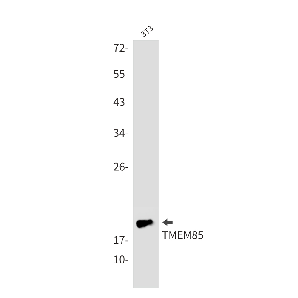 Transmembrane Protein 85