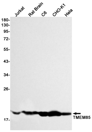 Rabbit Monoclonal Antibody to Transmembrane Protein 85