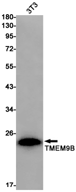 Rabbit Monoclonal Antibody to Transmembrane Protein 9B