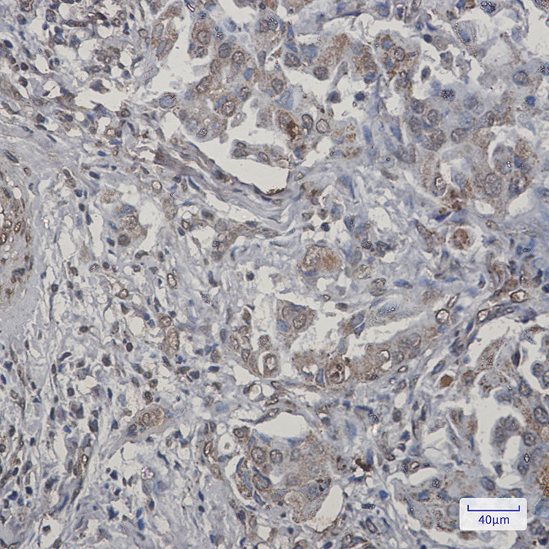 Rabbit Monoclonal Antibody to TNFAIP3