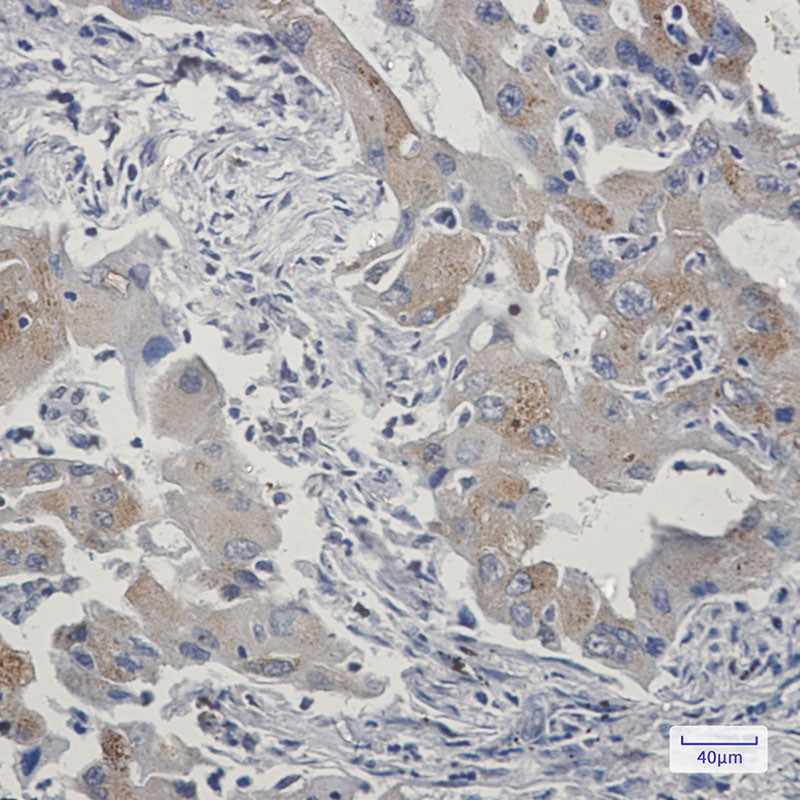 Rabbit Monoclonal Antibody to TAX1BP1