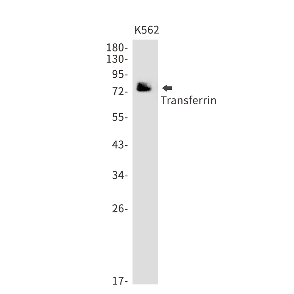 Transferrin