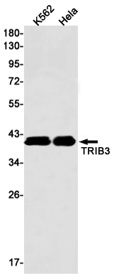 TRIB3
