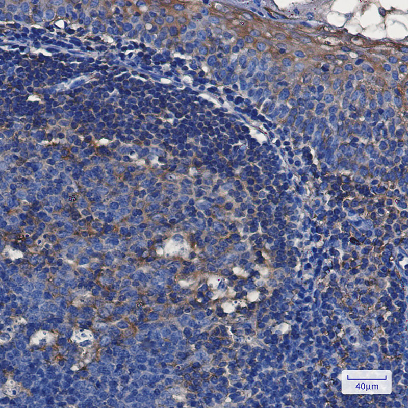 Rabbit Monoclonal Antibody to TFG