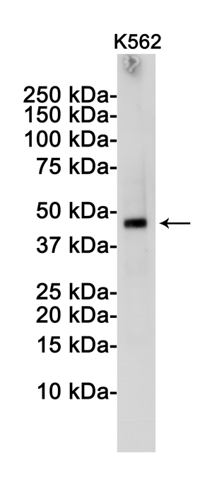 TSG101