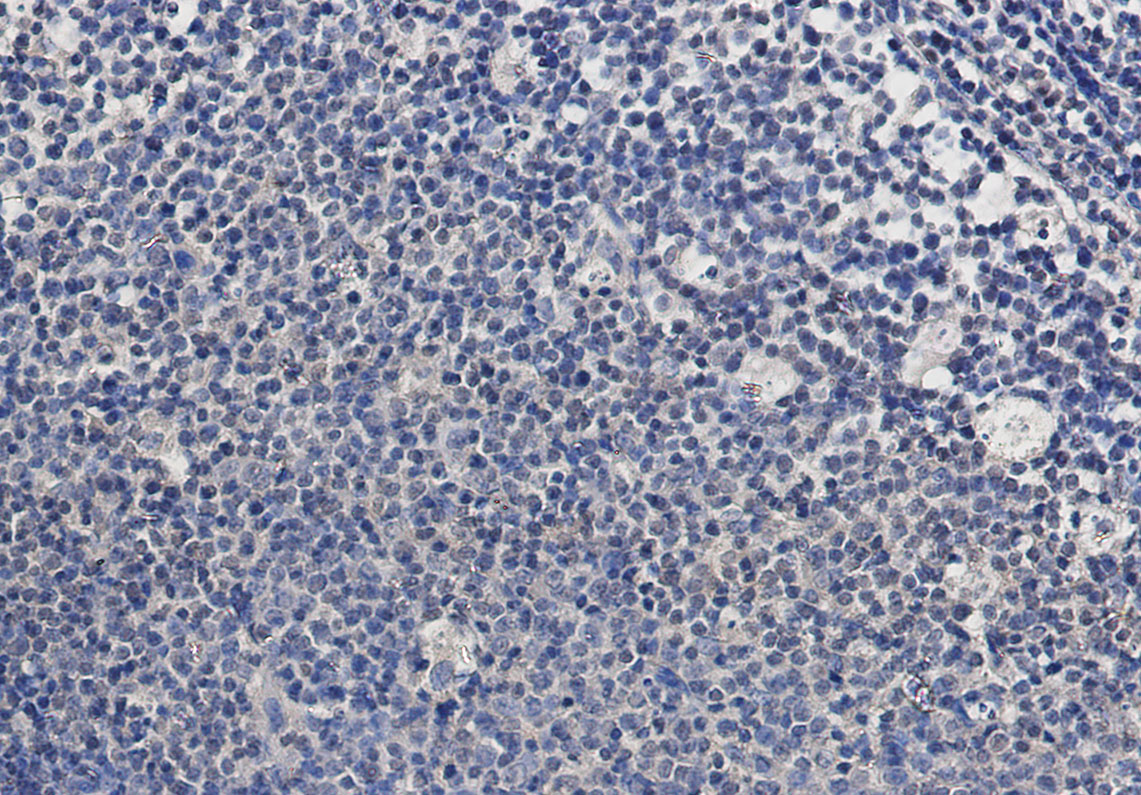 Rabbit Monoclonal Antibody to TSG101