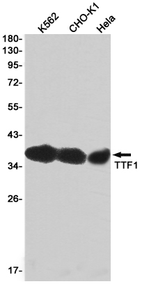 Thyroid Transcription Factor 1