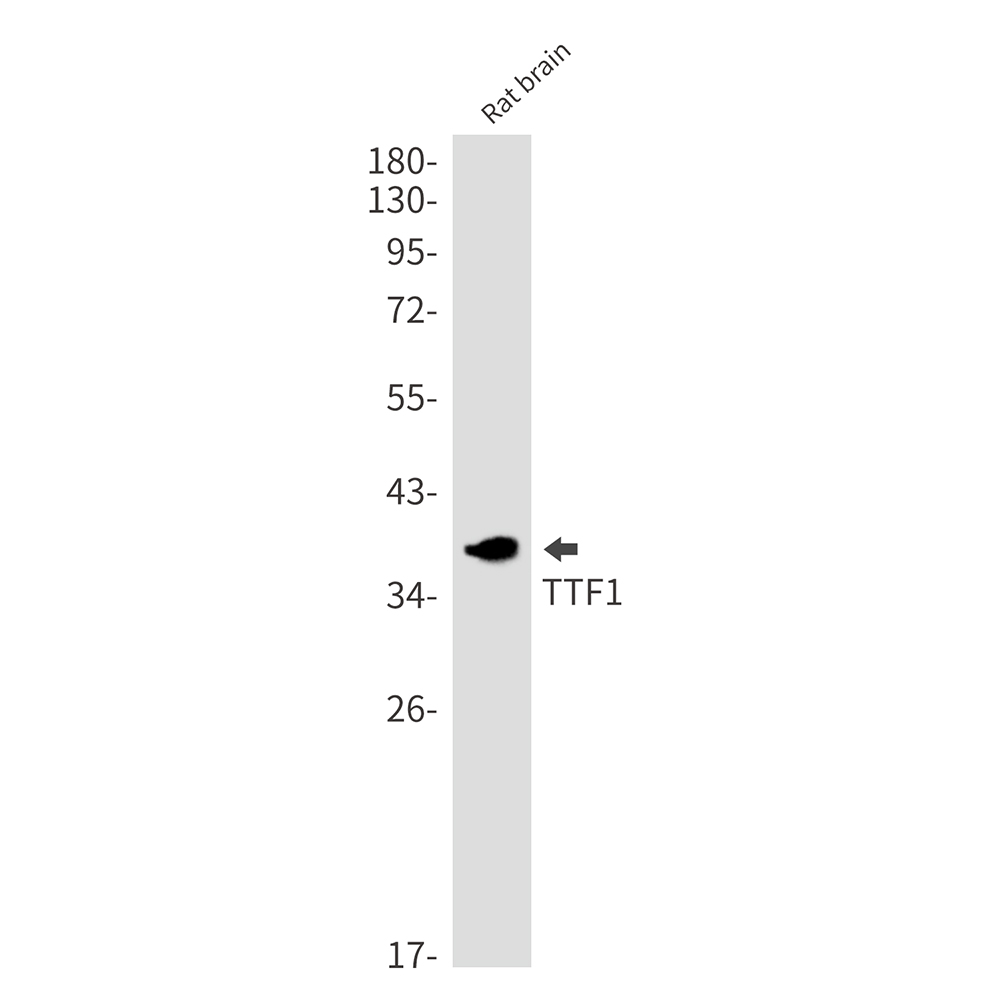 Thyroid Transcription Factor 1